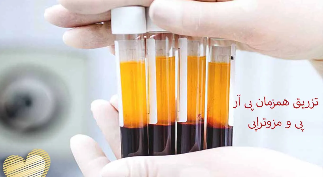 Simultaneous-injection-of-PRP-and-skin-mesotherapy